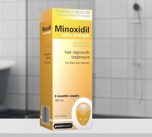 Can Minoxidil Stop Hereditary Hair Loss?