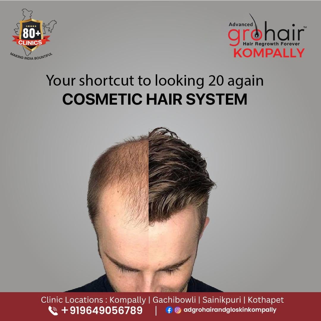Best Hair Clinic in Kompally