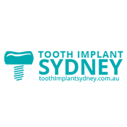 Opt for Low Cost Dental Implants in Sydney
