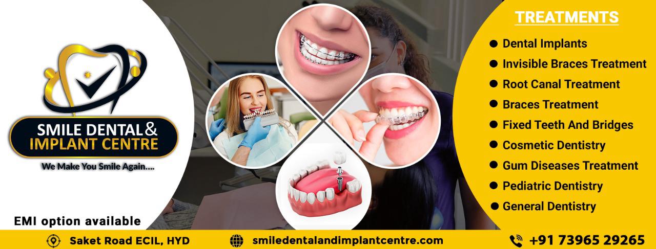 Best Dental Clinic in AS Rao Nagar, Ecil, Kapra Secunderabad.