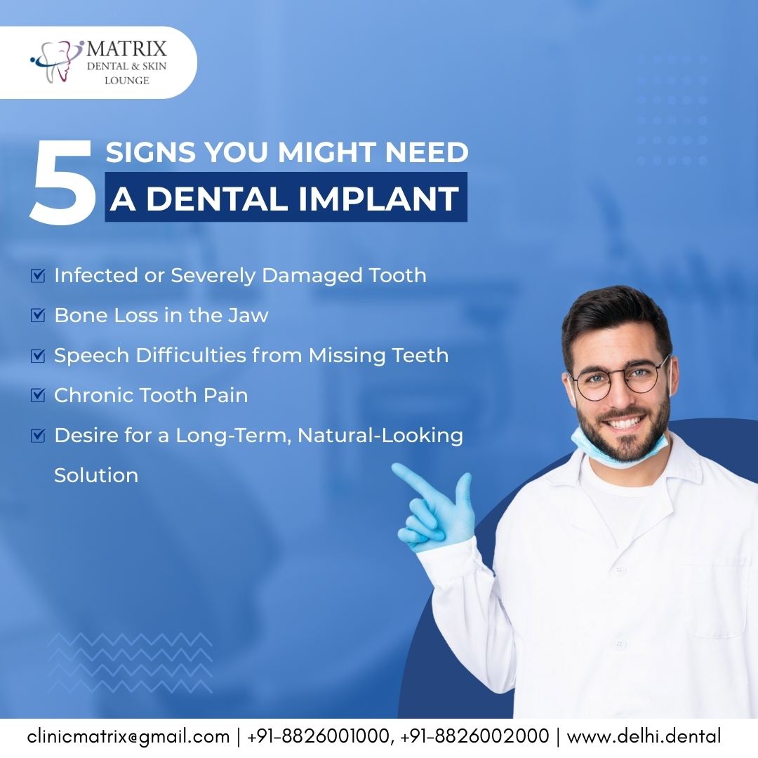Delhi Full Mouth Dental Implants: Cost, Procedure & Results