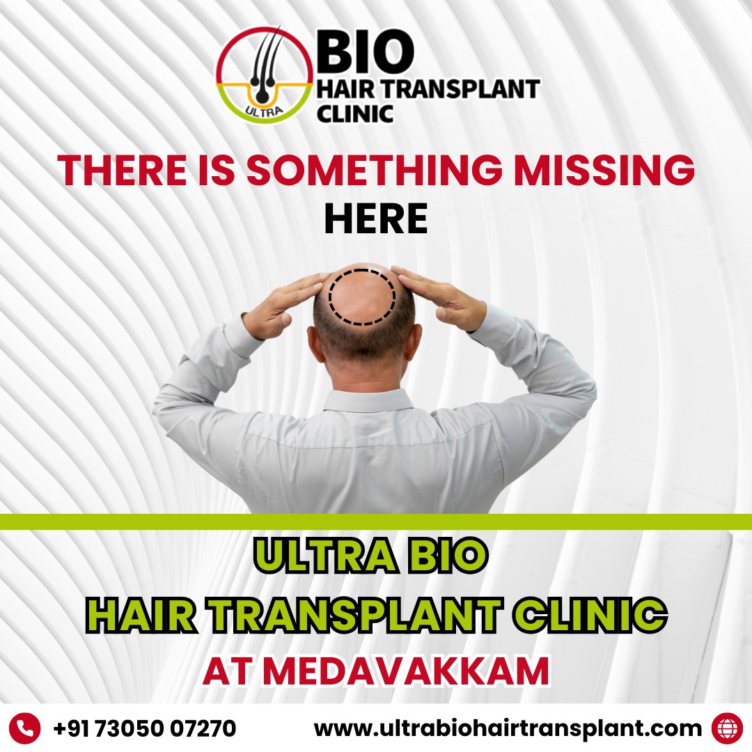 Best hair transplant in chennai