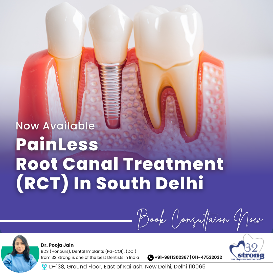 32 Strong Dental | Painless RCT In Delhi
