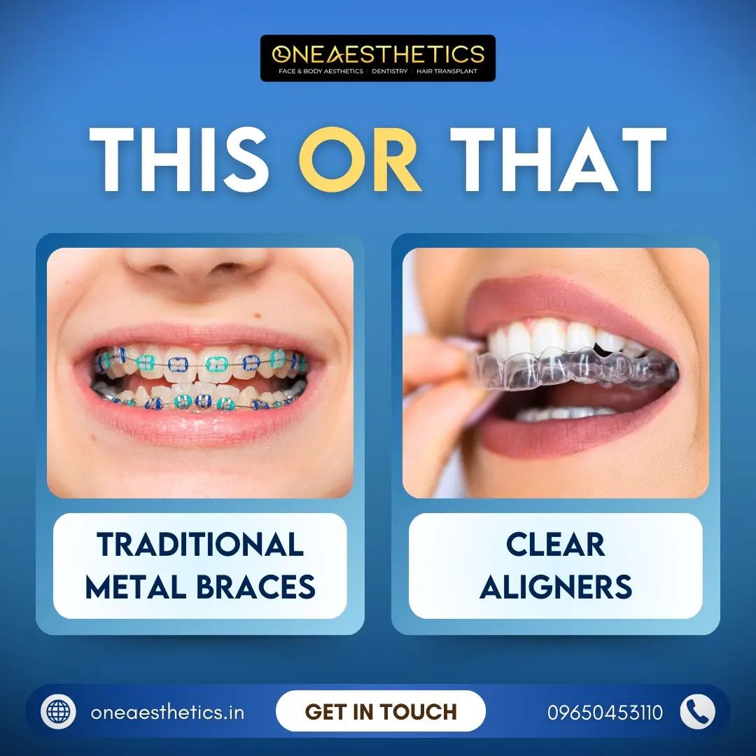 Restorative Dentistry Specialist in Gurgaon