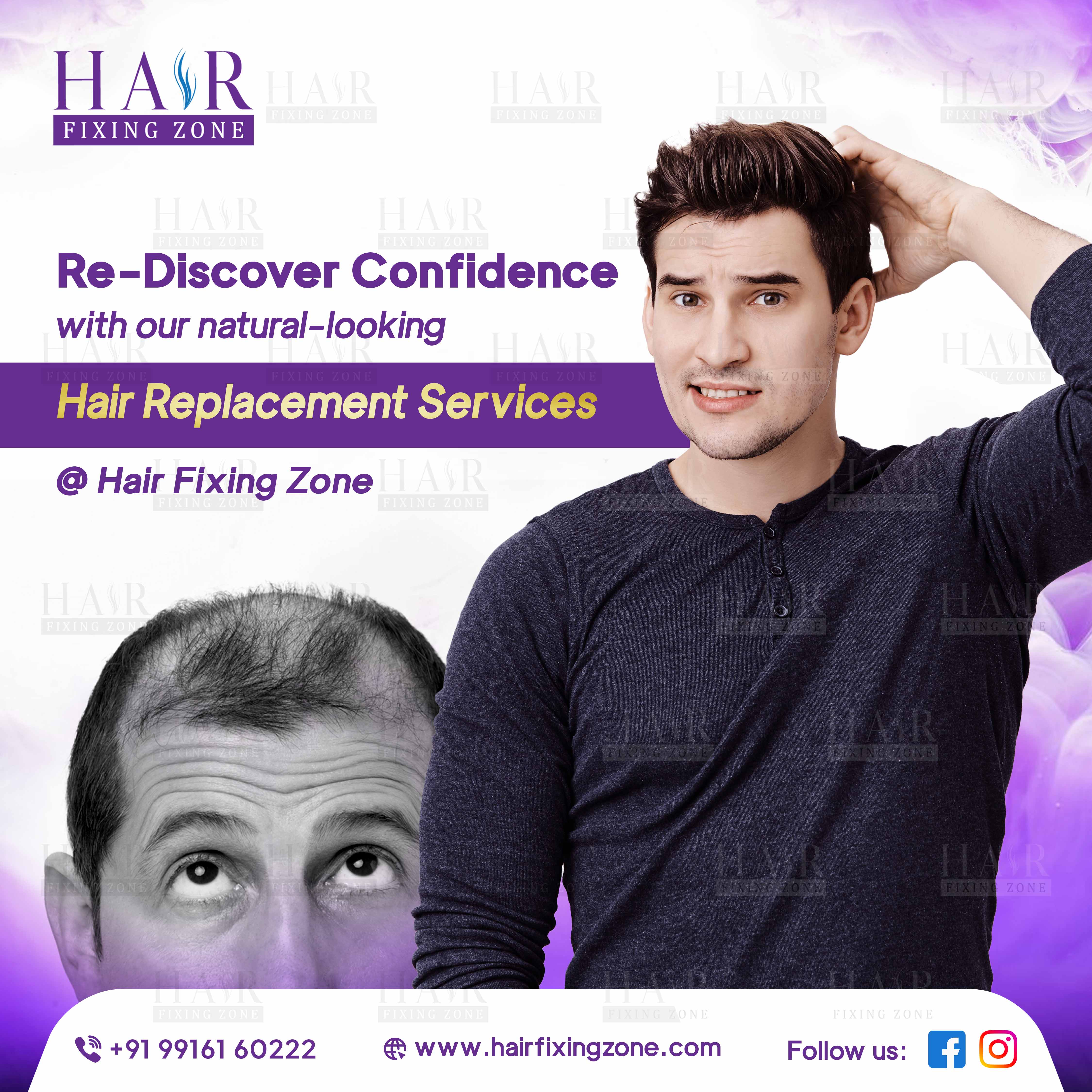 Best Hair Replacement Services for Men in Bangalore | Hair Fixing Zone Sarjapur Road
