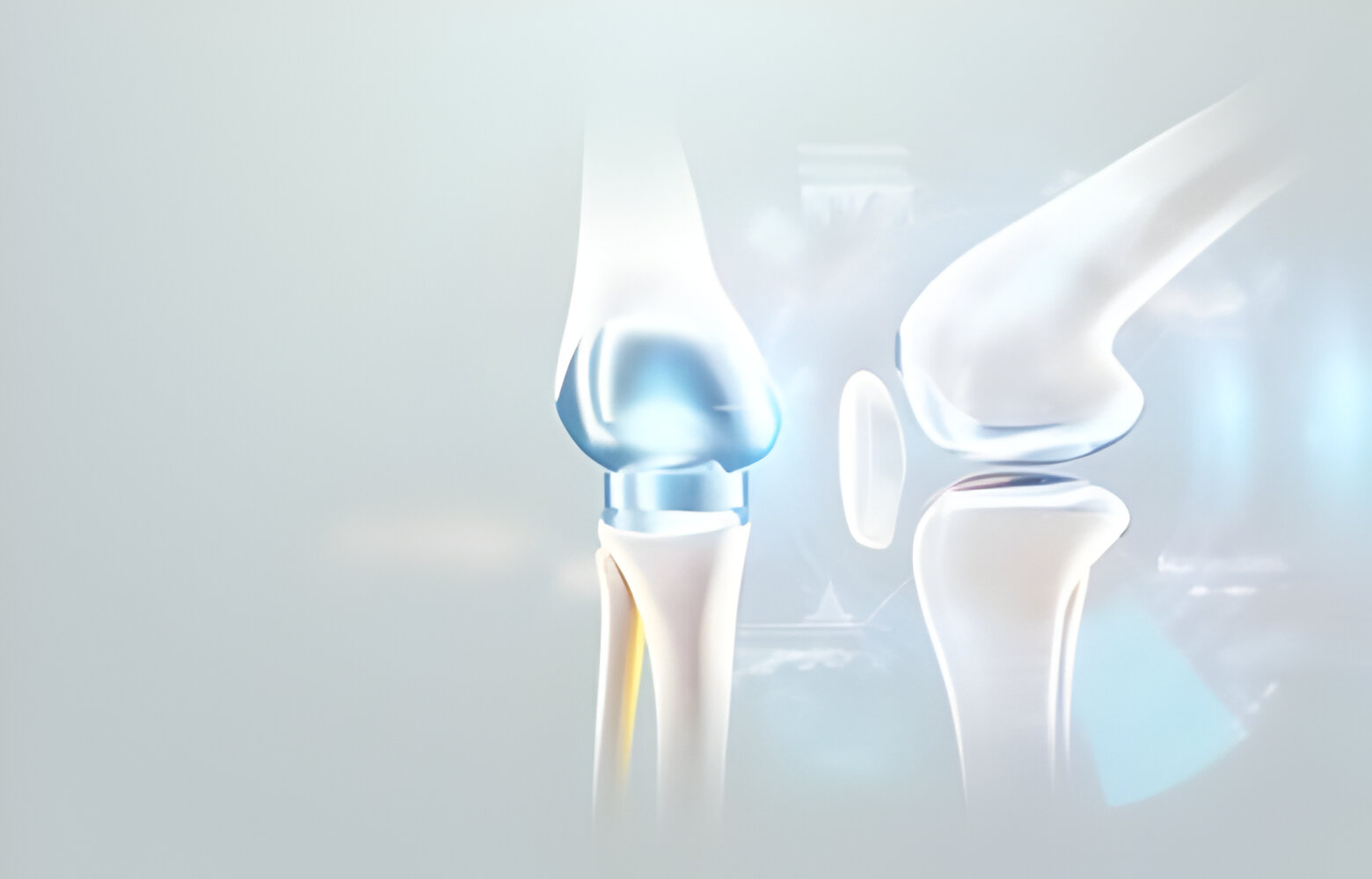 Elite Orthopaedics