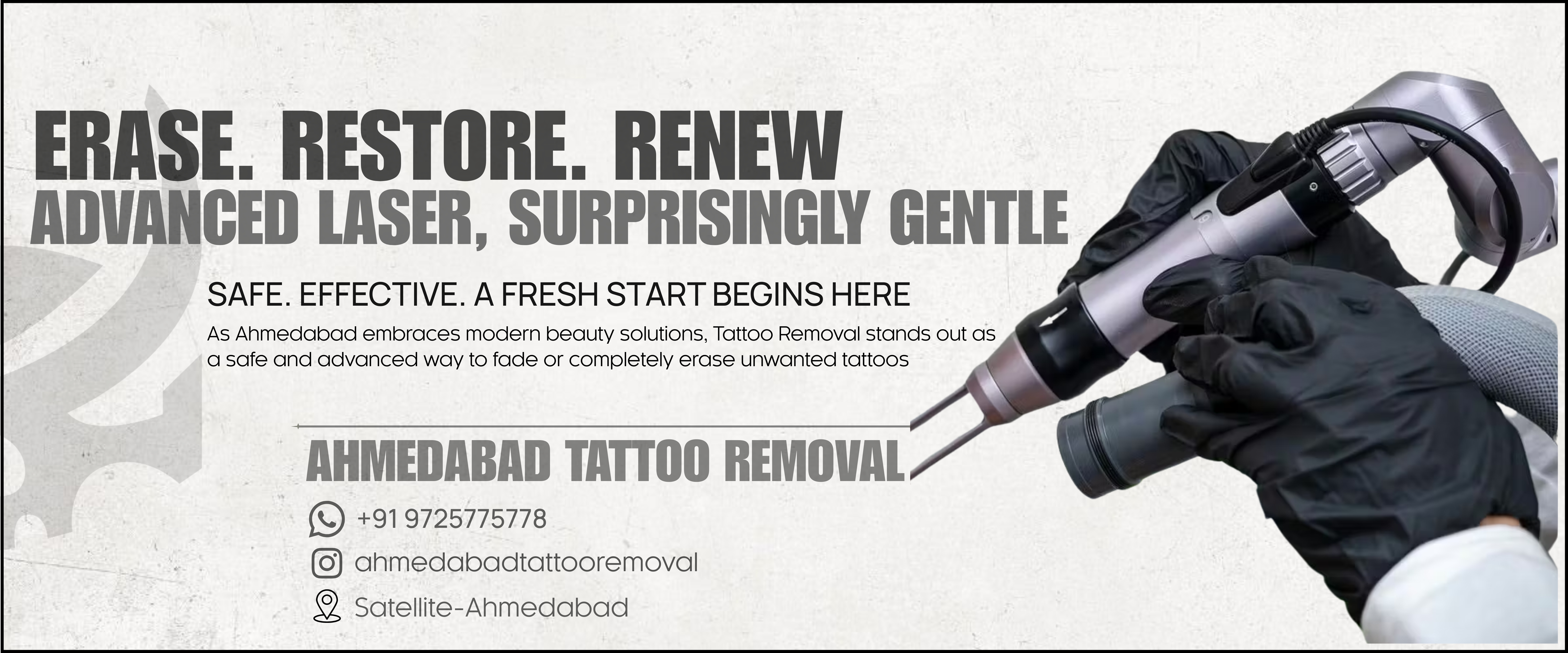 AHMEDABAD TATTOO REMOVAL