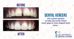 DR. ANUJ BAROLIA’S DENTAL STUDIO