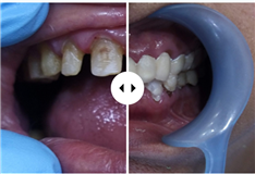 UR'S TOOTHFULLY FULL MOUTH REHABILITATION AND IMPLANT CENTRE