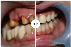 UR'S TOOTHFULLY FULL MOUTH REHABILITATION AND IMPLANT CENTRE