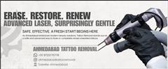AHMEDABAD TATTOO REMOVAL
