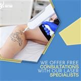 AHMEDABAD TATTOO REMOVAL
